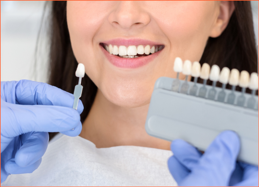 smile solutions